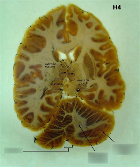H4 Brain Slice Cerebellum Diagram Quizlet