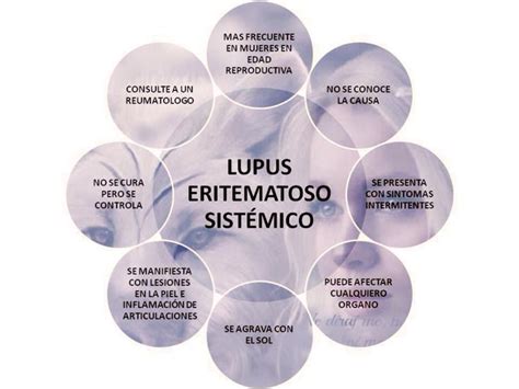 Lupus Eritematoso Sistémico Lupus Lupus Symptoms Fibromyalgia