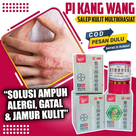 Bisa Cod Salep Pi Kang Wang Kl Hl Obat Gatal Alergi Jamur Panu