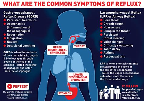 Laryngopharynx Reflux