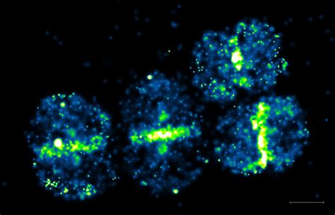 Microscope Bacteria Labeled Micropedia