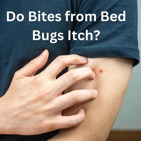 Do Bites From Bed Bugs Itch What You Need To Know Nm Pest Control