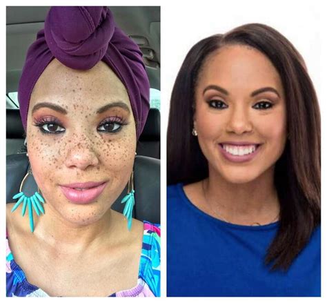 Abc 13 Anchor Frees Her Freckles To Show Natural Beauty Houston