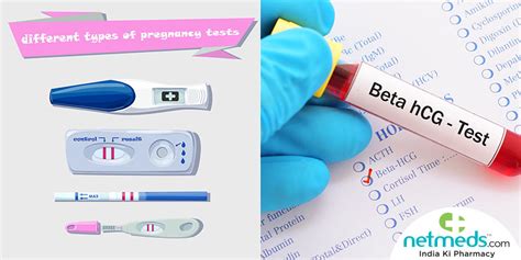 Pregnancy Test What Is It And What To Expect