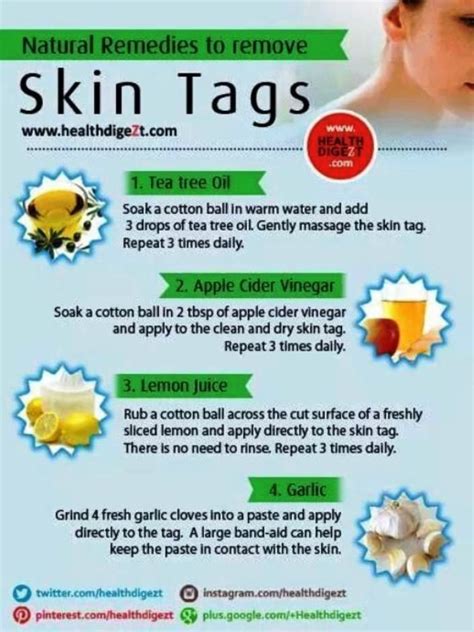 how to remove skin tags yourself naturally this infographic details how to remove skin tags