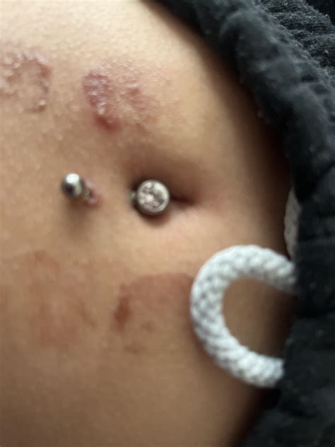 Best Navel Piercing Images On Pholder Piercing Piercing Advice