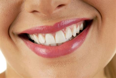 Considerations For Campbelltown Teeth Whitening World Of