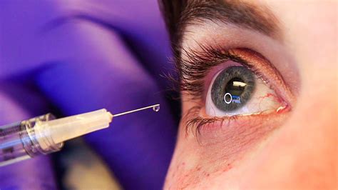 Women Get Eye Injection For The First Time