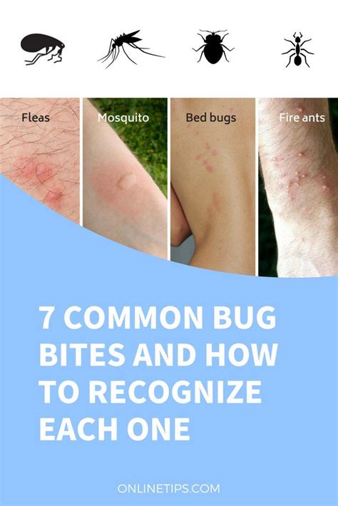 Types Of Mosquito Bites Pictures Peepsburgh