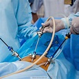 Laparoscopia - Paquetes quirúrgicos y complementarios - Union Medical
