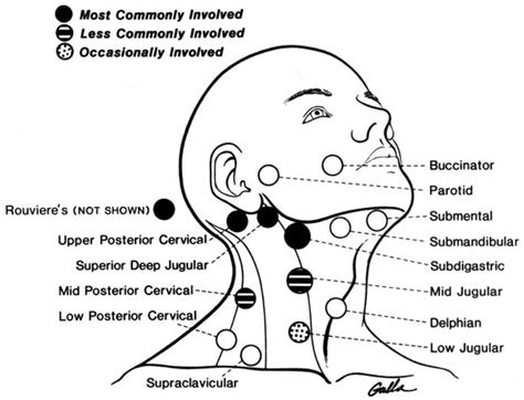 Nasopharyngeal Carcinoma Clinical Assessment And Review Of 176 Cases