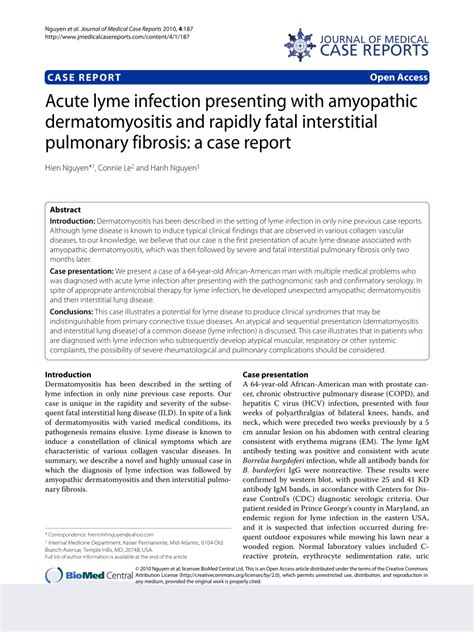 Lyme Disease Lung Problems Captions Tempo