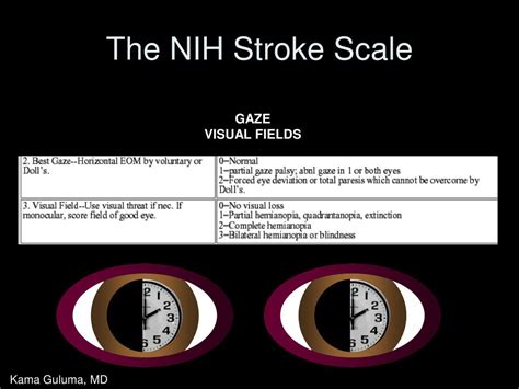 Ppt Stroke Systems And Stroke Scales In The Management Of Acute