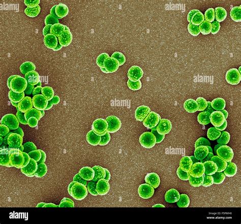 MRSA Bacteria Coloured Scanning Electron Micrograph SEM Of