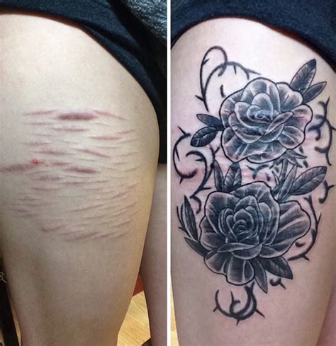 10 amazing scar cover up tattoos part 12