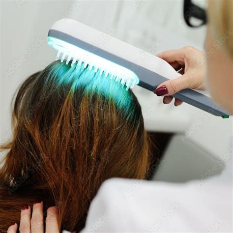 Anti Dandruff Treatments Vernon Skin And Hair Clinic