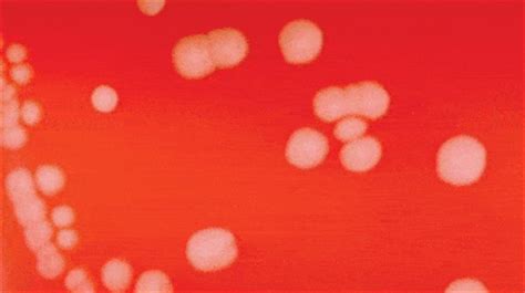 Previously, a blood agar overlay technique has been described by blanco et al. Laboratory diagnosis of Meningitis-Key points