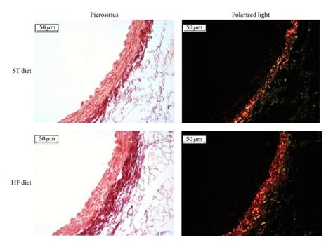 Collagen Content In Aortae Representative Photomicrographs Of Mouse