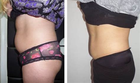 The bread trick has worked countless times for. £250 Aqualyx injection is helping dieters slim down by ...
