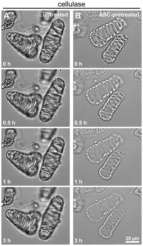 Time Lapse Brightfield Microscopy Was Used To Image Untreated A And