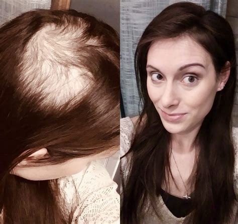 What Are The Best Hairstyles For Very Thin Hair Hair Adviser Kembeo