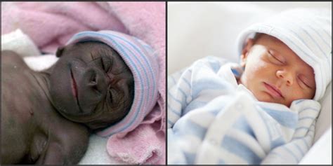 Humangorilla Hybrid Infant Born In India