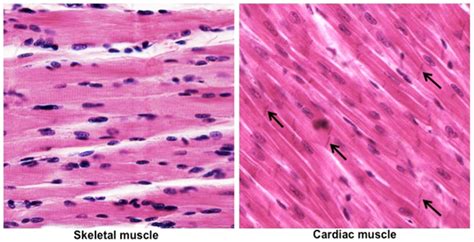 The cardiac muscle is the muscle of the heart and medically is. Human Structure Virtual Microscopy