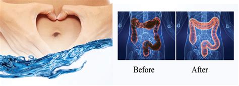 colon hydrotherapy taste4health