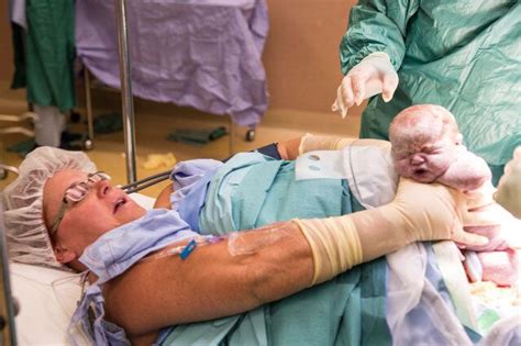 Woman Delivers Her Own Twins During Maternal Assisted Caesarean