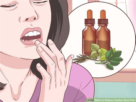 3 Ways To Relieve Canker Sore Pain Wikihow