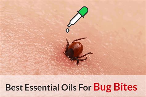 What Bit Me The Ultimate Guide About Essential Oils For Bug Bites