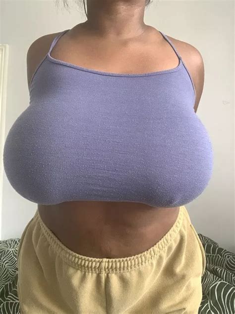 Woman Who Has Trouble Breathing As Breasts Are So Big Has To Pay For Own Surgery Leeds Live