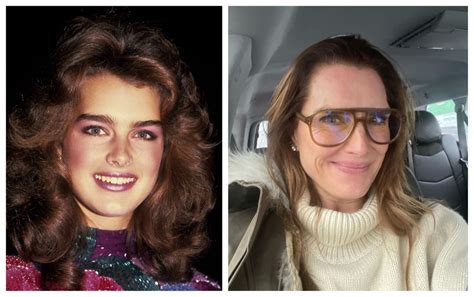 Brooke Shields Face Lift Did She Get Botox Or Her Nose Done