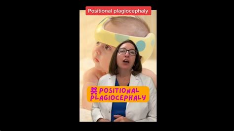 Positional Plagiocephaly Pediatrics Short Leveluprn Youtube