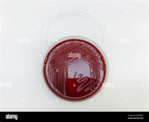 A Staphylococcus Aureus Bacteria Displayed On A Blood Agar Plate On