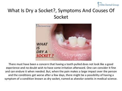 what dry socket symptoms and couses