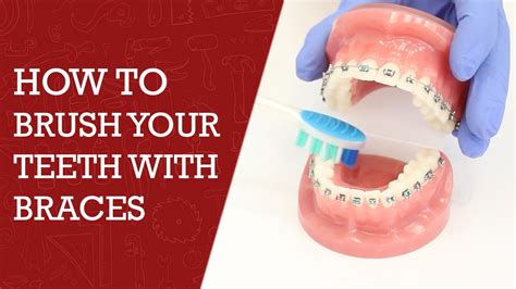 When you have braces brushing your teeth properly becomes even more important than before. How to Brush Teeth with Braces | Orthodontics Tips #braces ...