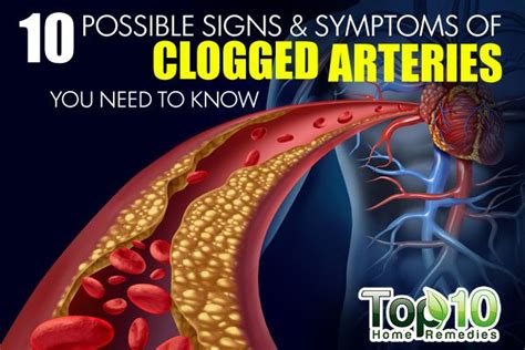 The carotid arteries supply blood to the large, front part of the brain, where thinking, speech. 10 Possible Signs and Symptoms of Clogged Arteries You Need to Know - Page 2 of 3 | Top 10 Home ...
