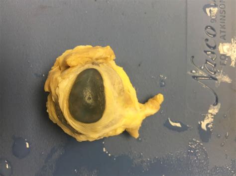 Anatomy And Physiology Blog Sheep Eye Dissection