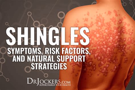 Shingles Symptoms Risk Factors And Natural Support Strategies Red