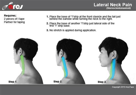 Lateral Neck Pain Ares Theratape Education Center Neck Pain