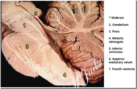 To recognize the principal features of the brainstem that are visible with the unaided eye, including the general location of cranial nerve nuclei and the. Brain stem | Medatrio