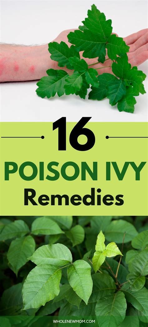 18 Home Remedies For Poison Ivy Plus Id And Prevention Tips Poison Ivy Remedies Poison Ivy