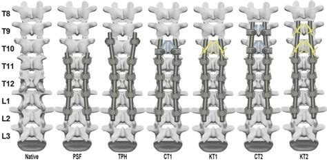 Biomechanical Evaluation Of Different Semi Rigid Junctional Fixation