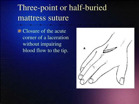 Ppt Advanced Suturing Techniques Powerpoint Presentation Free