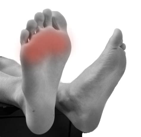 Ball Of Foot Pain Footpoint Podiatry