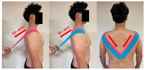 Life Free Full Text Effects Of Kinesiology Taping On Shoulder Posture And Peak Torque In