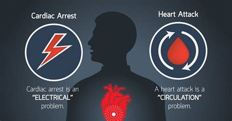 Heart Attack Vs Cardiac Arrest Difference Between Heart Attack And