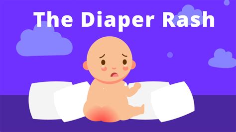 The Diaper Rash Causes Symptoms And Treatments Tiny Medicine