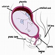Questioning Childbirth Positions - ProNatal Fitness